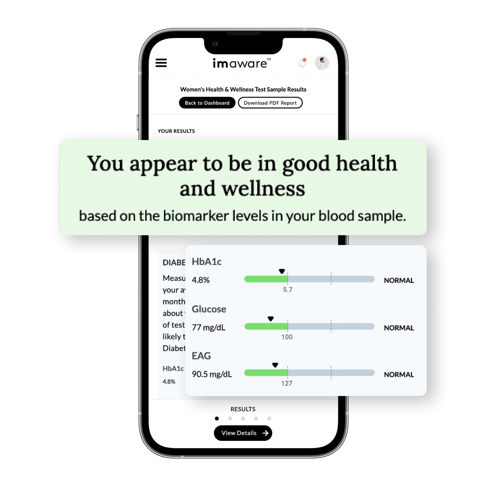 Because Prediabetes / Diabetes Screening Kit